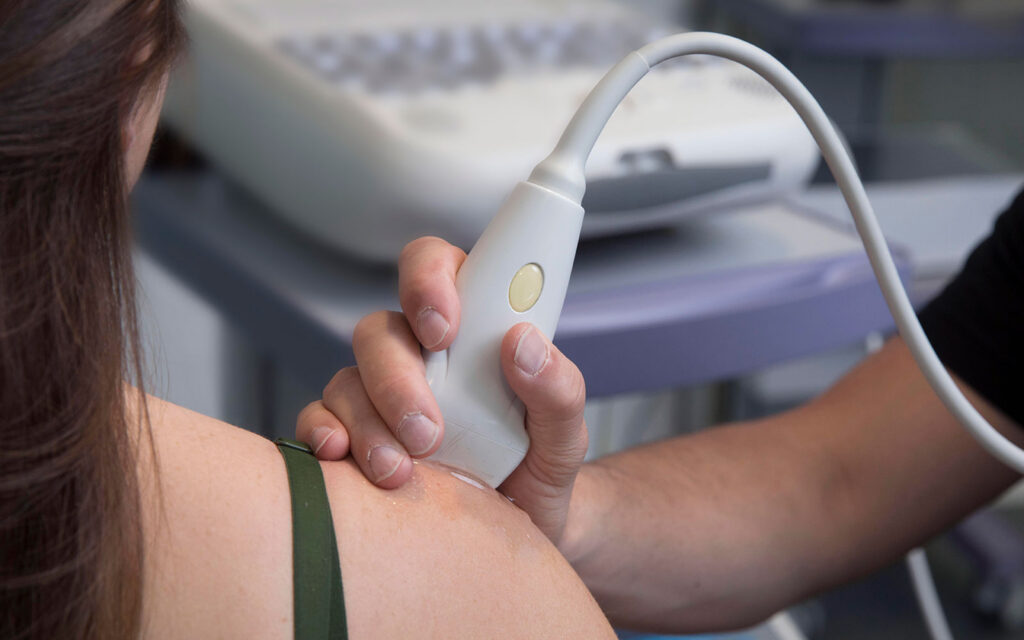 Schoudertherapie alpha fysiotherapie utrecht