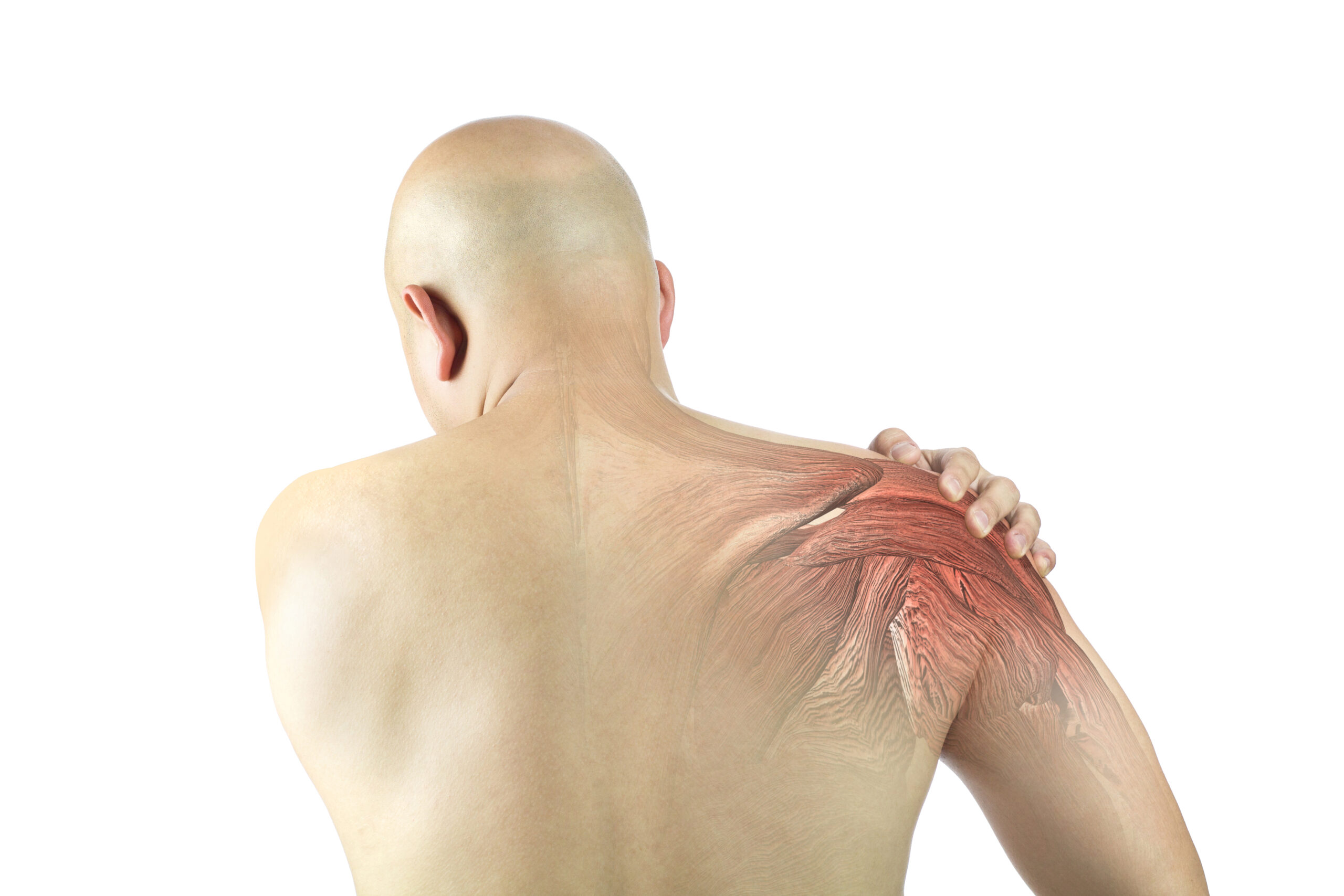 supraspinatus_tendinopathie